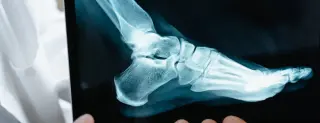 Healthy feet for life