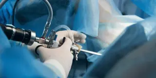 Agora o Citoclin realiza histeroscopia ambulatorial diagnóstica: mais conforto e precisão em um só e