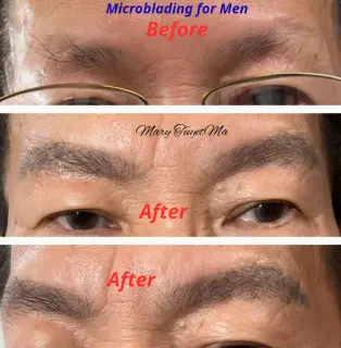 Mr. Antony (40 years old)