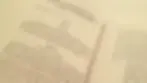 Anti-damping, Gözetim, Kotalar, Ek Vergiler, Sübvansiyonlar