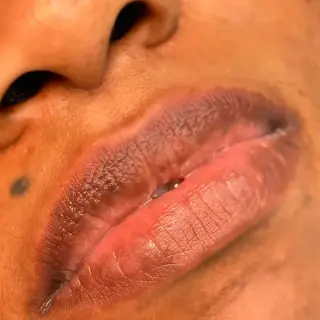 — Before