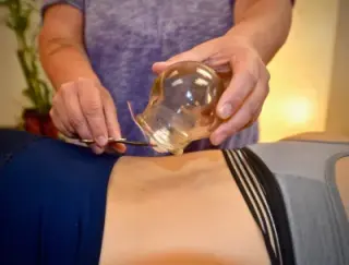 Jenn treating a patient with fire cupping