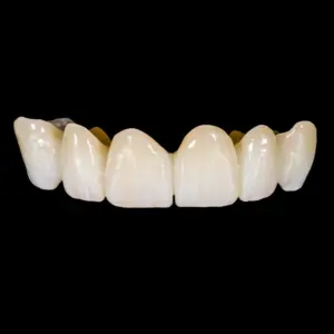 Corona zirconia-ceramica