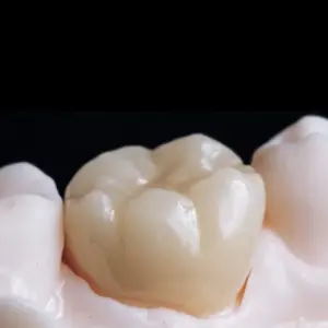 Corona zirconia integrale
